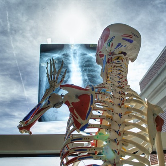 skeleton-2561573_640 skeleton-2561573_640